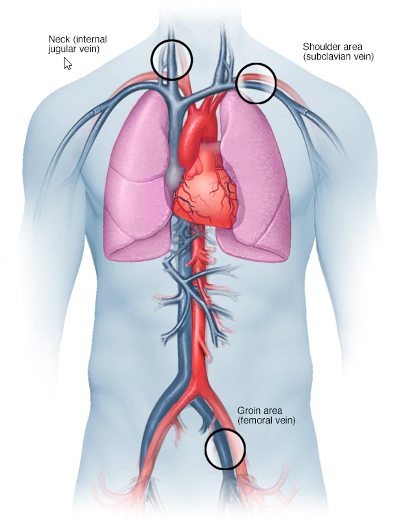 matthew banks heart valve